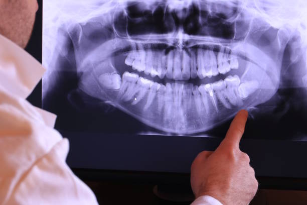 Best Emergency Dental Care for Broken or Chipped Teeth in Silverton, OH