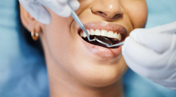 Best Emergency Wisdom Teeth Removal in Silverton, OH